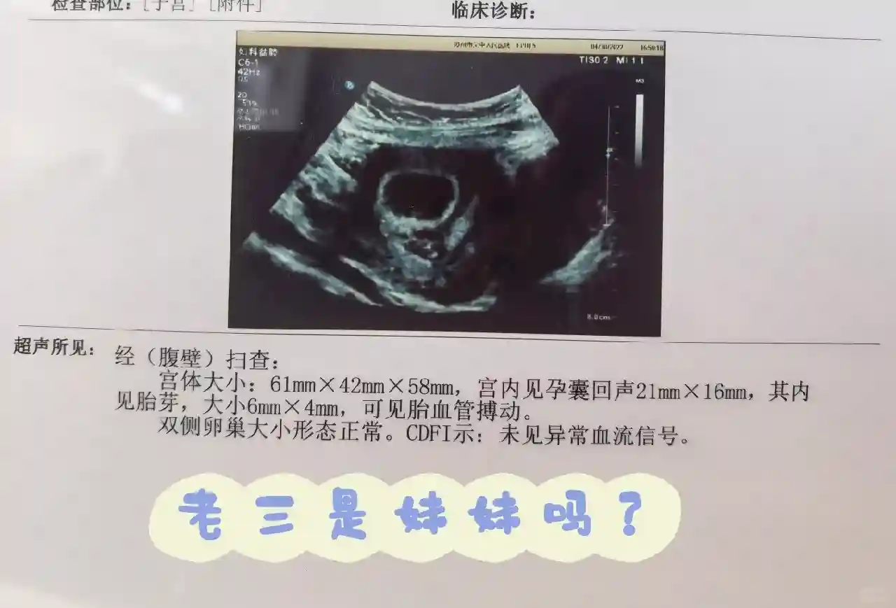 第三胎胚胎形状与性别预测