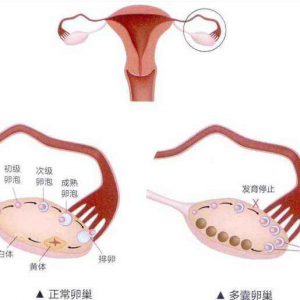 精液常规检查费用解析与权威助孕机构
